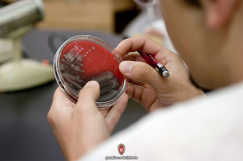 Blood agar